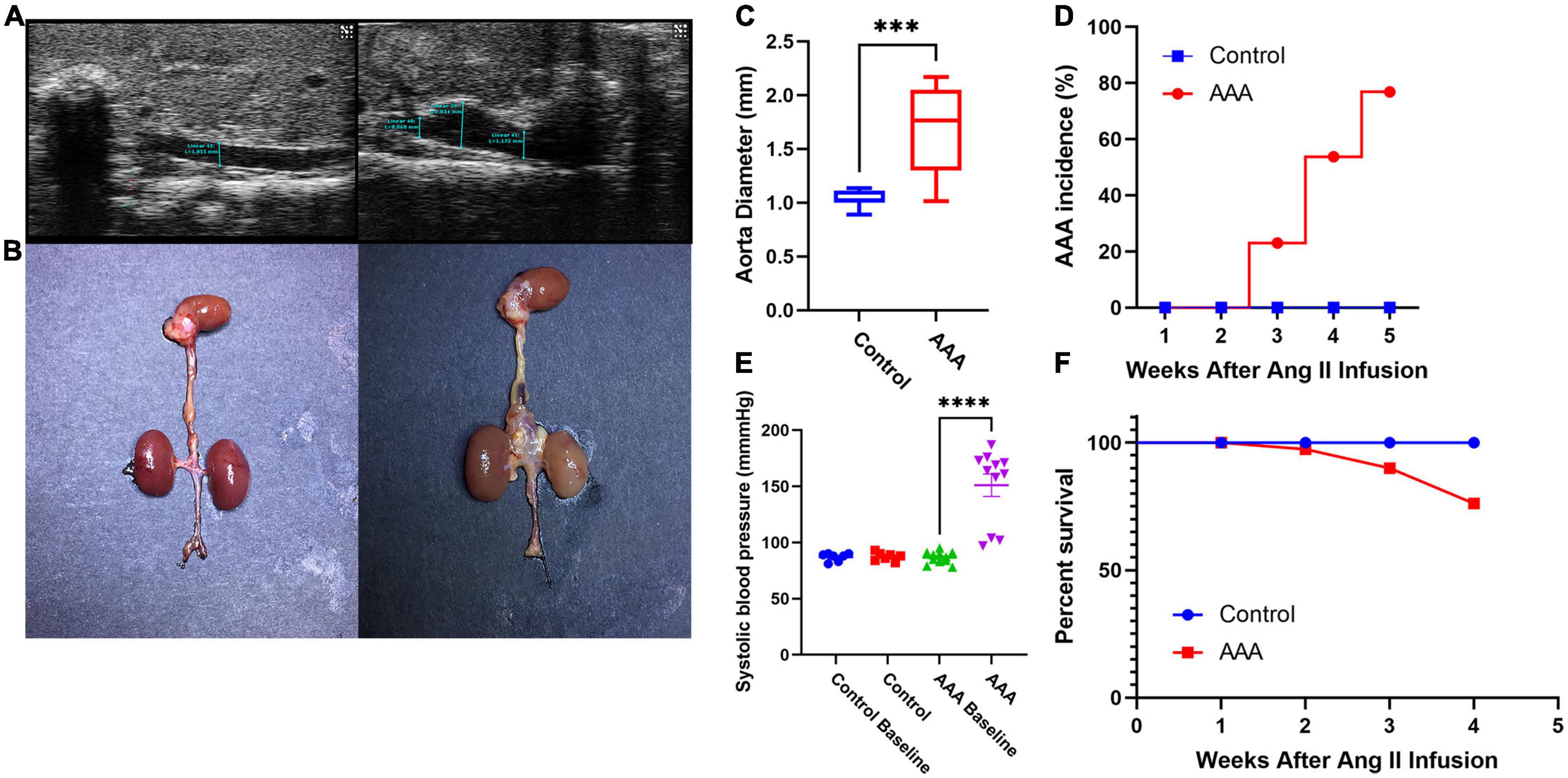 The gut microbiota in experimental abdominal aortic aneurysm